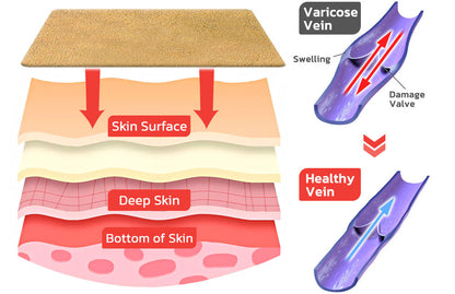 Veinless™ Immediate Relief Patch ( BUY 1 GET 1 FREE )
