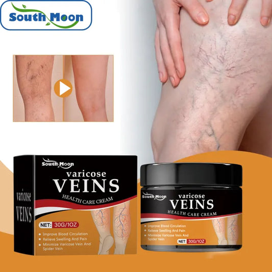South Moon Varicose Veins Remover Cream ( BUY 1 GET 1 FREE )
