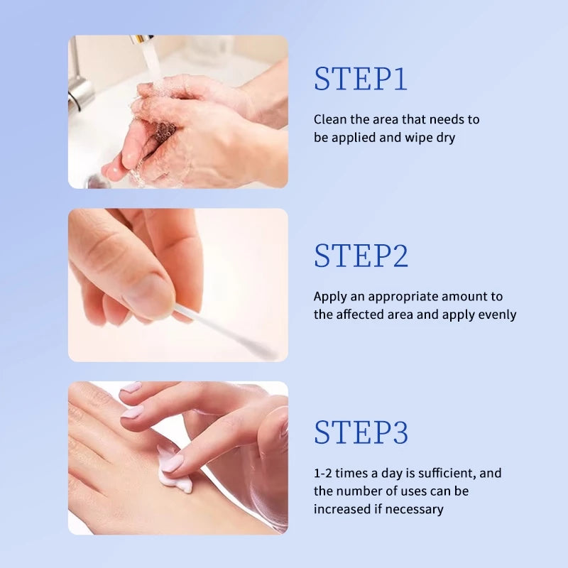 🌙🧴 South Moon Wart Care Cream – Removal & Skin Smoothing