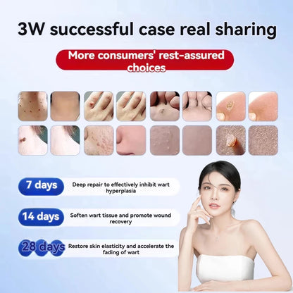 🌙🧴 South Moon Wart Care Cream – Removal & Skin Smoothing