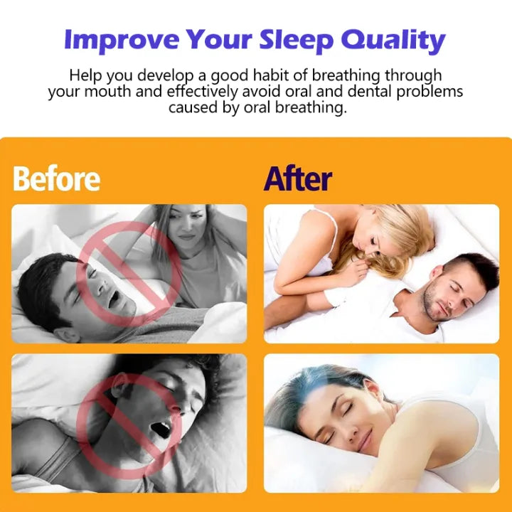 Pack Of 30 - Mouth Correction Sticker Night Breathing Patch