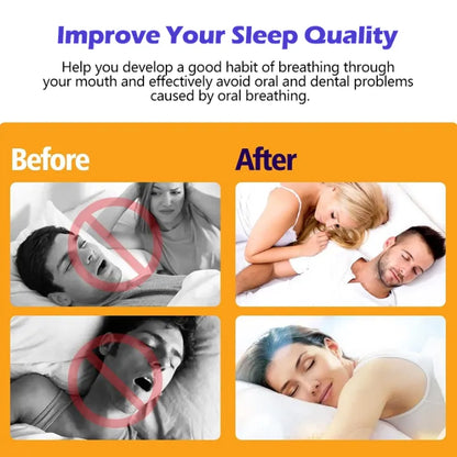 Pack Of 30 - Mouth Correction Sticker Night Breathing Patch