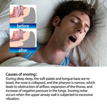 South Moon Anti-Snoring Patch ( BUY 1 GET 1 FREE )