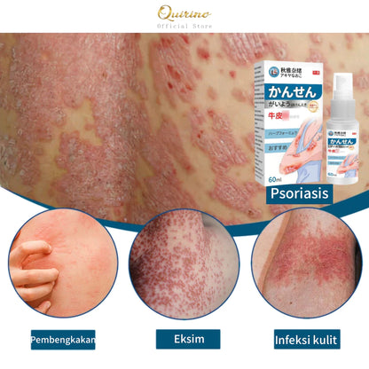 Japanese psoriasis spray ( BUY 1 GET 1 FREE )