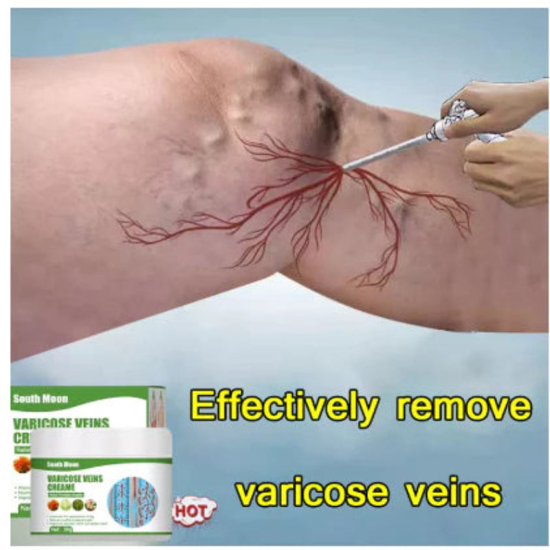 South Moon Varicose Vein Cream ( BUY 1 GET 1 FREE )