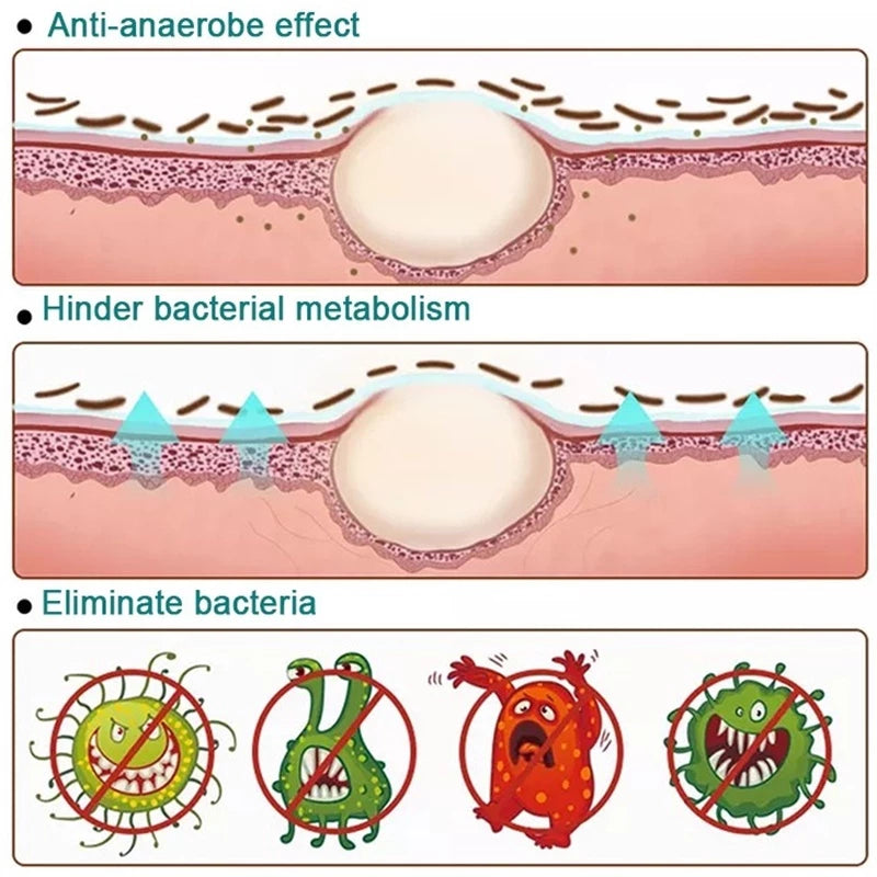 Japanese psoriasis spray ( BUY 1 GET 1 FREE )
