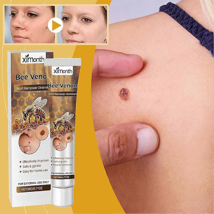 Ximonth  Bee Venom Warts Removal Ointment ( BUY 1 GET 1 FREE )