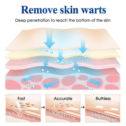 Hitworker™ Skin Tag patch ( BUY 1 GET 1 FREE )