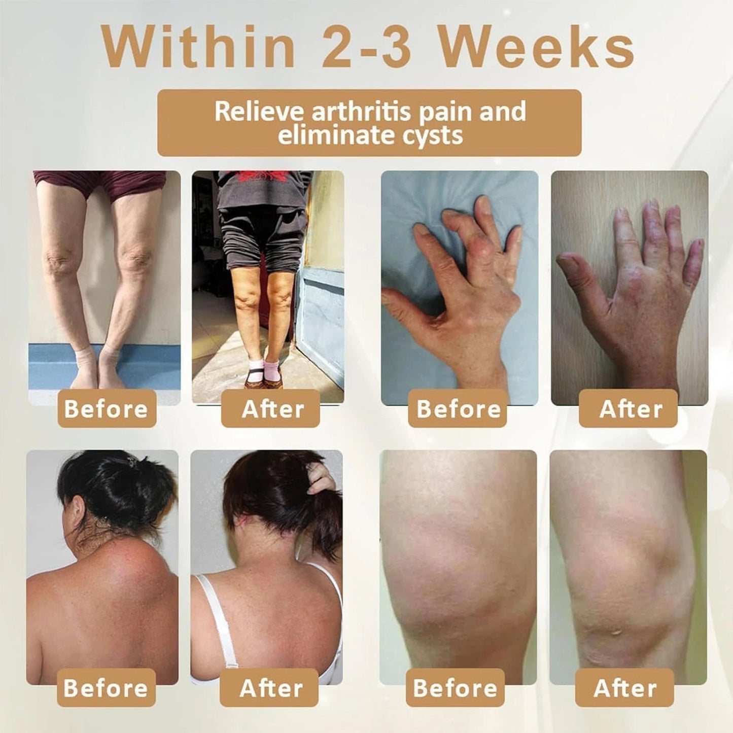 Emu Oil Turmeric Joint Pain Relief Gel ( BUY 1 GET 1 FREE )