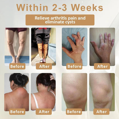 Emu Oil Turmeric Joint Pain Relief Gel ( BUY 1 GET 1 FREE )