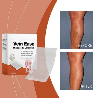 VeinEase™ Varicose Vein Microneedle Patch ( BUY 1 GET 1 FREE )