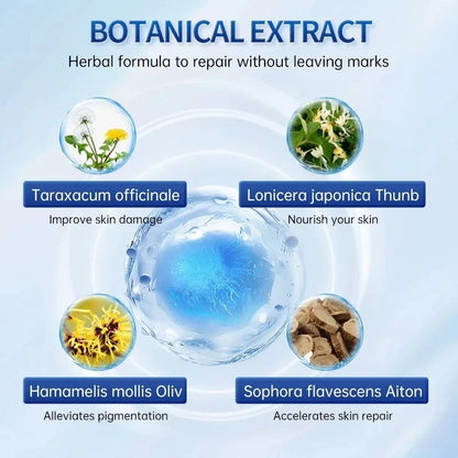 🌙🧴 South Moon Wart Care Cream – Removal & Skin Smoothing